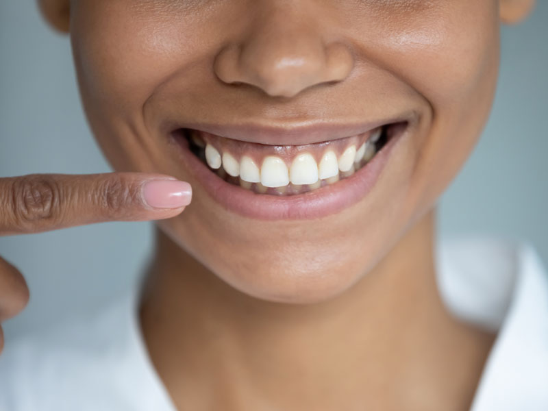 Patient with Braces